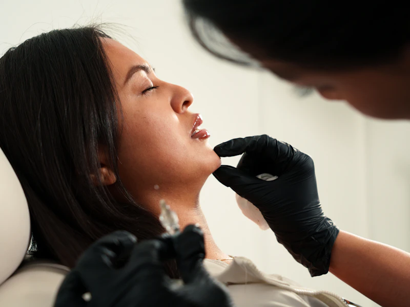 Aplicación de bioestimuladores en consulta de estética médica en Mangle Médica, Tlalnepantla