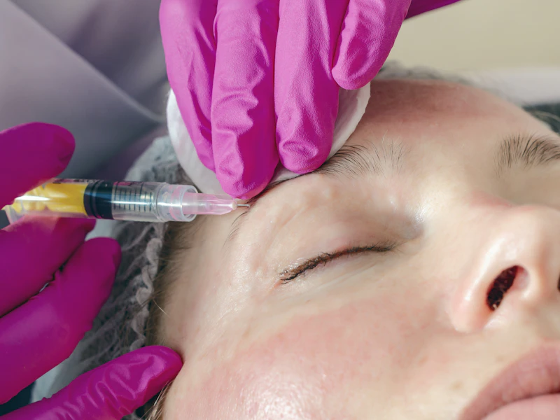 Mesoterapia facial aplicada por personal médico en Mangle Médica, Tlalnepantla
